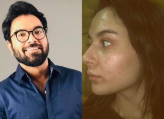 Hania Amir calls Yasir Hussain out on his ‘inappropriate joke’ on her struggle with acne
